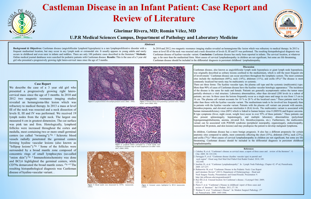 Castleman Disease in an Infant Patient - Case Report and Review of Literature