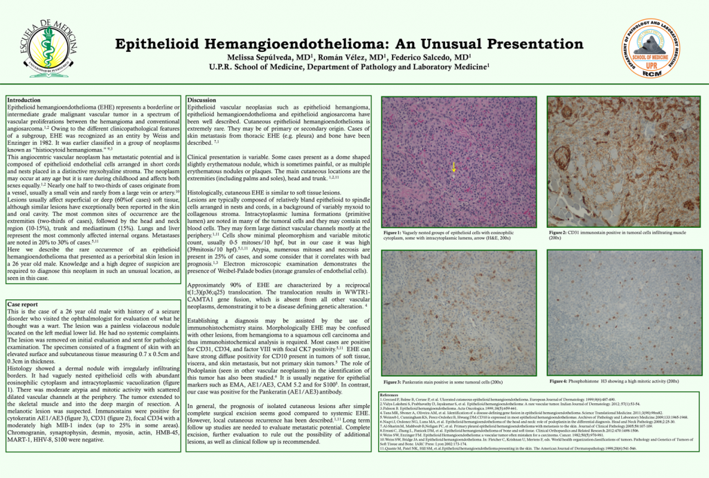 Epithelioid Hemangioendothelioma - An Unusual Presentation