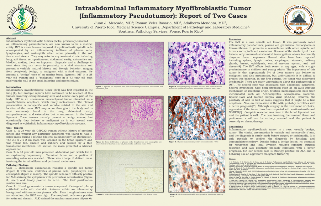 Intraabdominal Inflammatory Myofibroblastic Tumor (Inflammatory Pseudotumor) Report of Two Cases